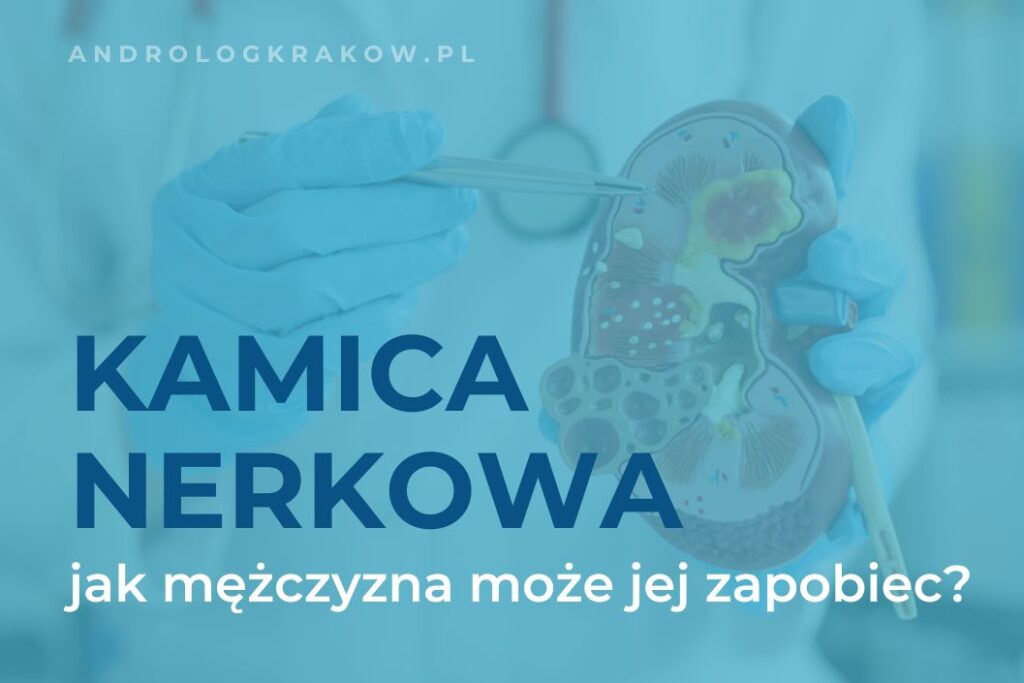 Jak zapobiegać kamicy nerkowej u mężczyzn – co robić, by uniknąć kamieni nerkowych?